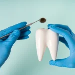 Tooth Extractions