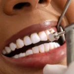 Dental Cleanings